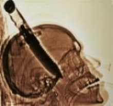 police scientifique rayonsX
