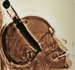 police scientifique preuve rayonsX police scientifique preuve rayonsX